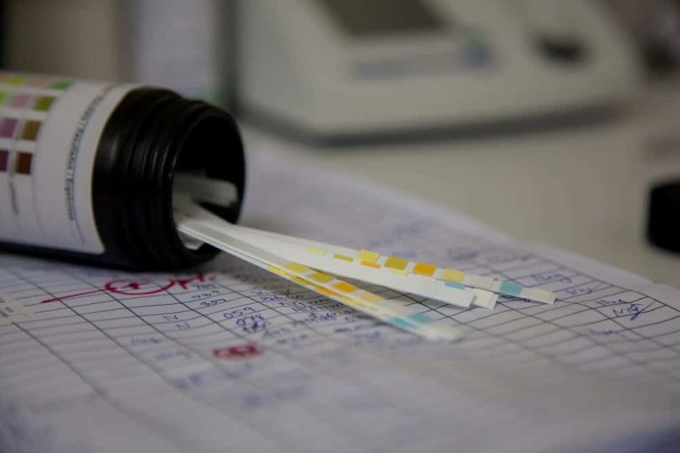 Test na drogu – Šta predstavlja, kako se radi i koliko je pouzdan?